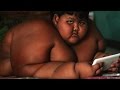 Kisah Arya Anak 10 Tahun Dengan Berat 188kg
