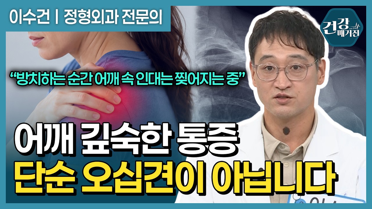 어깨가 자꾸 빠진다면? 반복되는 어깨 탈구의 원인과 치료법 [건강매거진]