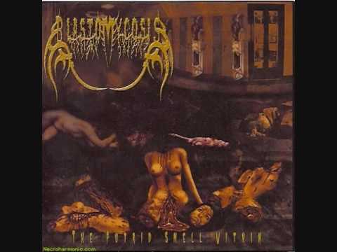 Blastomycosis - Exposed Slut Guts