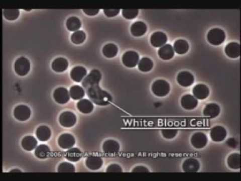 Acidic Blood vs Alkaline Blood Video