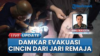 Damkar Natuna Lepaskan Cincin Tersangkut di Jari Remaja, Proses Evakuasi Berlangsung Tengah Malam