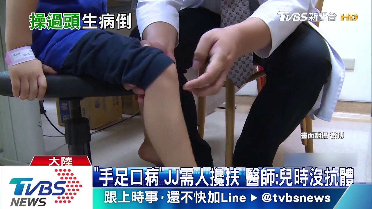 林俊傑罹患「手足口病」 嘴巴長70多顆潰瘍