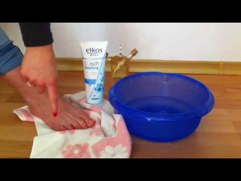 Rissige Fersen pflegen / Kur für rissige Fersen