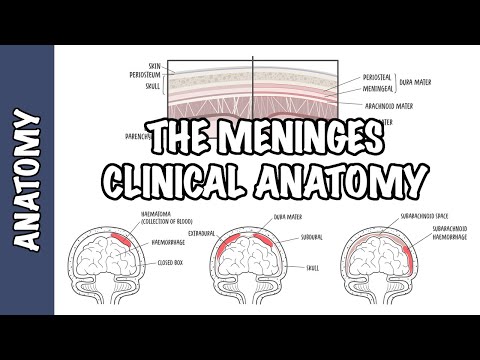 Anatomía clínica - Meninges (hematoma intracraneal, subdural, epidural, subaracnoideo meningitis)