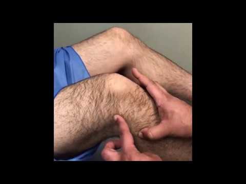 Anatomia funzionale del ginocchio per studenti