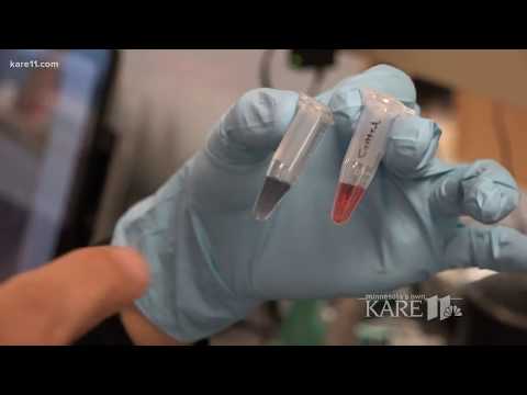 New tech may help diagnose Oak wilt in minutes