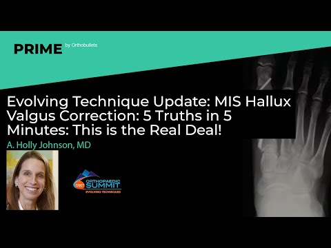 Evolving Technique Update: MIS Hallux Valgus Correctio 5 Truths in 5 Minutes - A. Holly Johnson, MD
