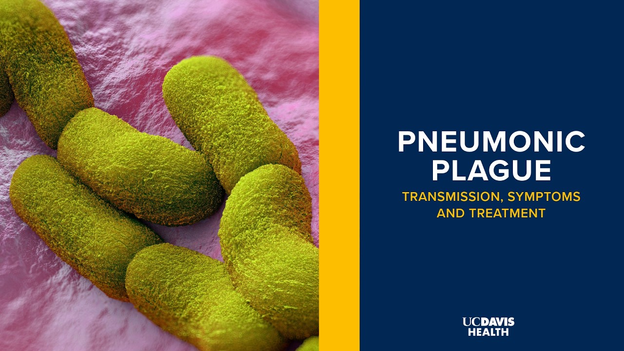 Thumbnail preview of Pneumonic Plague: Transmission, Symptoms and Treatment Explained