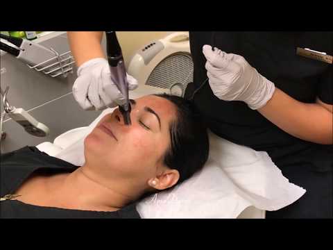 Micro Needling is rejuvenation and anti-aging treatment