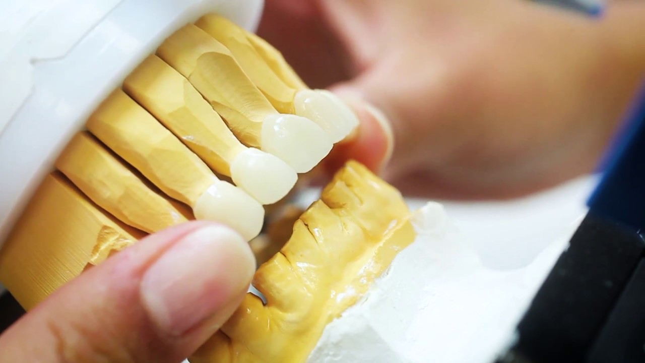 Porcelain Veneers NYC - Video