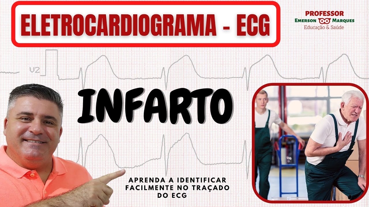 COMO IDENTIFICAR UM INFARTO NO ECG