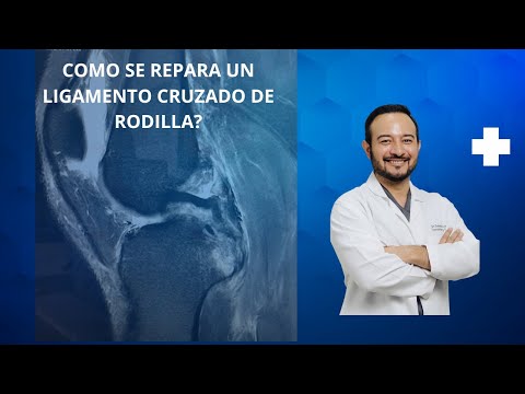 Cómo retomar el ejercicio después de una lesión