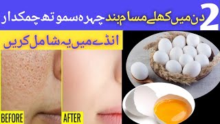 open paur remedy at home open pour treatment challenge herbal tips by Jannat
