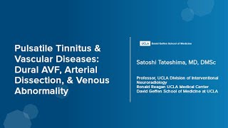 Pulsatile Tinnitus & Vascular Diseases | Satoshi Tateshima, MD, DMSc | UCLA Health