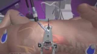 Standing Straight Again: Correcting Spinal Curvature