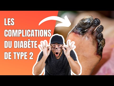 Complications Type 2 diabetes