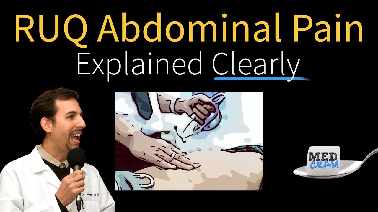 Abdominal Pain Explained Clearly - Right Upper Quadrant