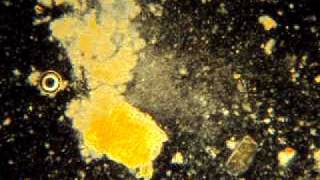 Bacilli T al microscopio in campo scuro