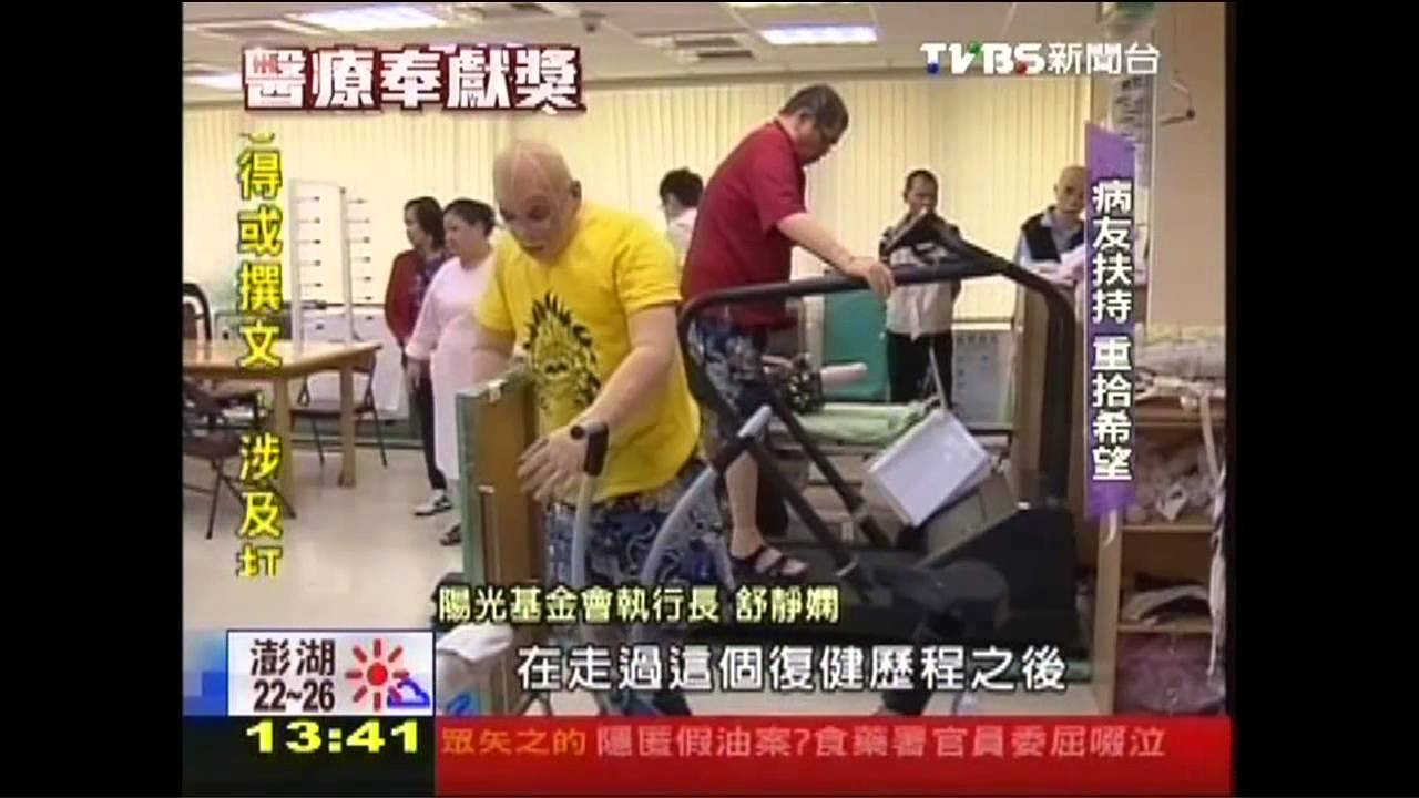 首設重建中心 助燒傷者重返陽光