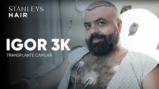 IGOR 3K Transplante Capilar -  STANLEY'S HAIR