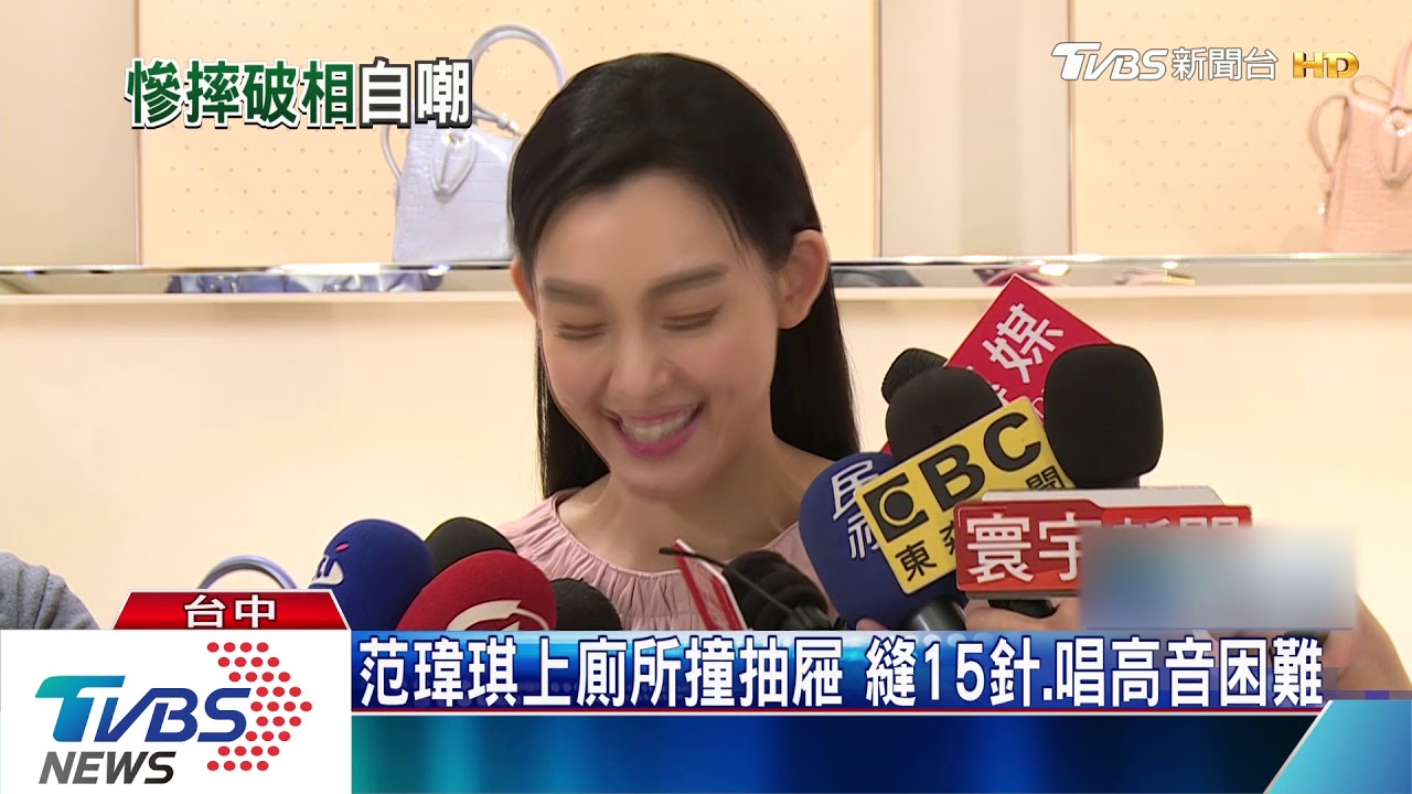 范瑋琪撞廁所抽屜拉桿　下巴流血縫15針