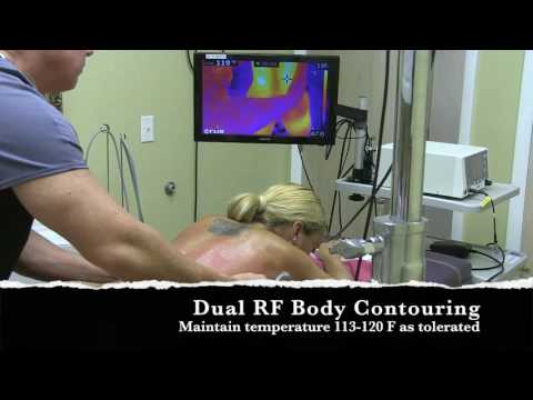 Venus Freeze torso G Facebook