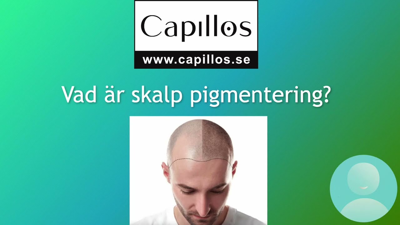 Vad är skalp pigmentering?