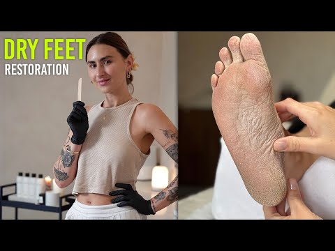 Making Dry Cracked Feet Look Fresh and Smooth After One Treatment