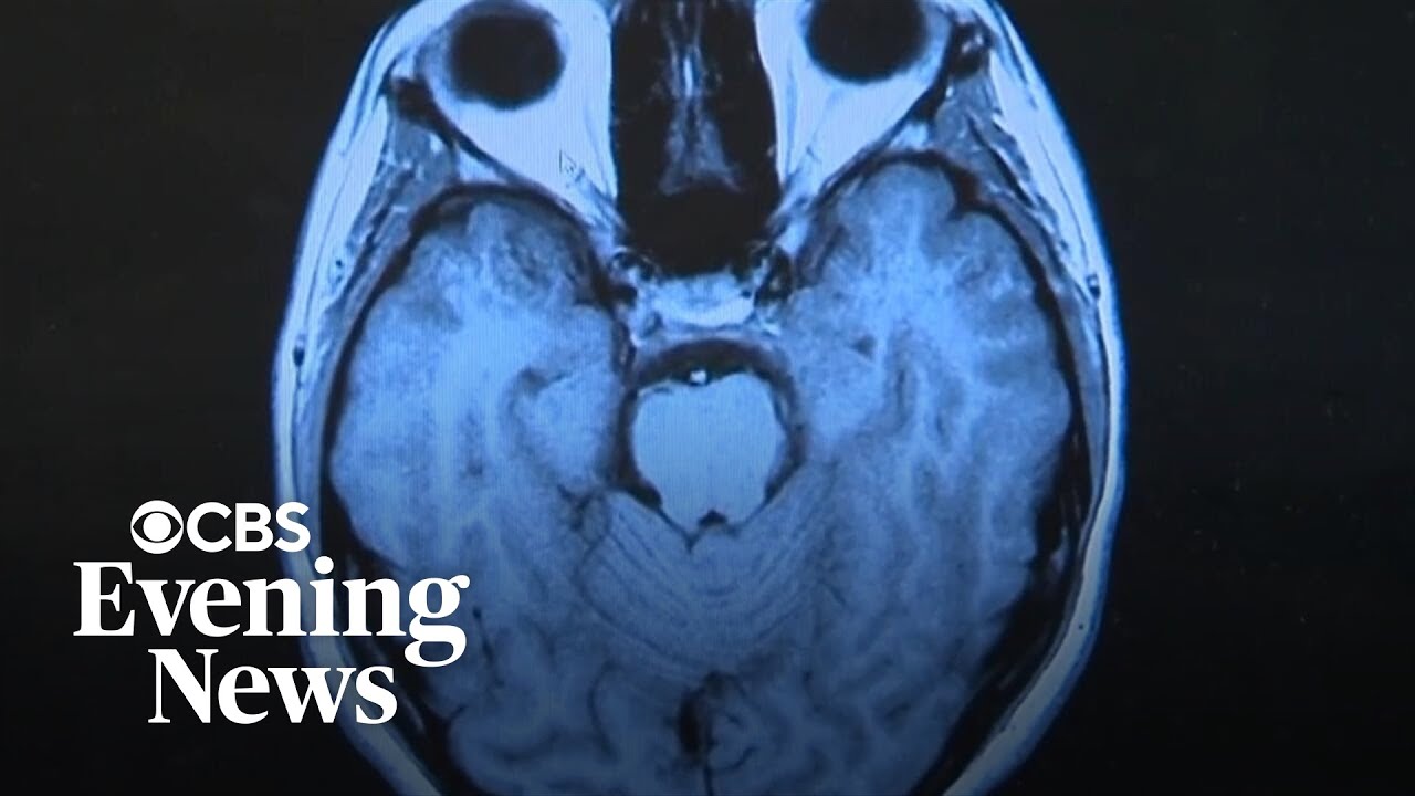 Researcher says Long COVID causing 