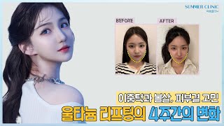 울타늄리프팅의 4주간의 변화 | 울타늄 브이로그