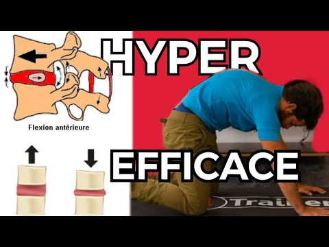 LUMBAGO: How to relieve acute back pain? (Quick fix #1)