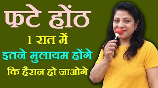 Lip Care - 3 Easy Cracked Lips Beauty Tips And Natural Home Remedies In Hindi