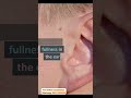 Symptoms of Ear Infection #healthylifestyle #healthtips #shorts #short