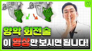 양악수술 회전? 역회전? 이 영상 한편으로 종결짓습니다| 서울대 구강악안면외과전문의 박재봉