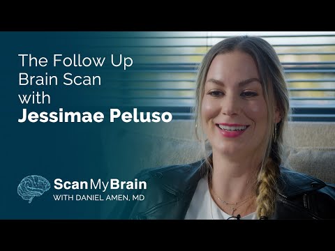The Follow Up Brain SPECT Scan with Jessimae Peluso