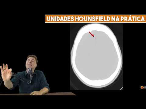 INTRODUÇÃO À TOMOGRAFIA   O BÁSICO PARA INICIANTES 1080p