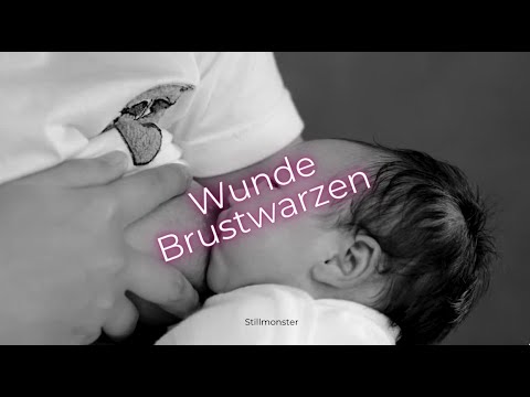 Stillen & Wunde Brustwarzen