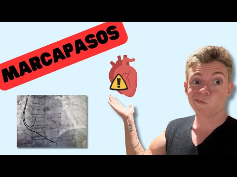 MARCAPASOS: CONVIÉRTETE EN EXPERTO 🚀