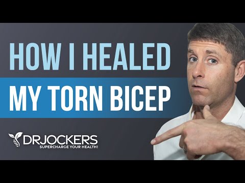 Distal Bicep Tendon Tear Recovery (Without Surgery)