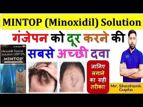 Mintop minoxidil 5 solution, for od, 5% w/v