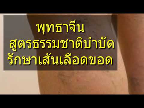 มีการเยียวยาชาวบ้านที่จะเพิ่มสมาชิก ลบสมาชิกในกระเพาะอาหารเพิ่มขึ้น