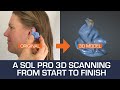 A SOL PRO 3D scanning from start to finish - SOL PRO 3D Scanner by Scan Dimension