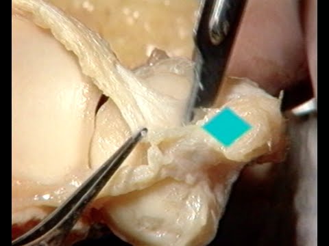 Nach wund Hüftgelenke Aufwachen Neurologie Behandlung mit Hals und Flanken
