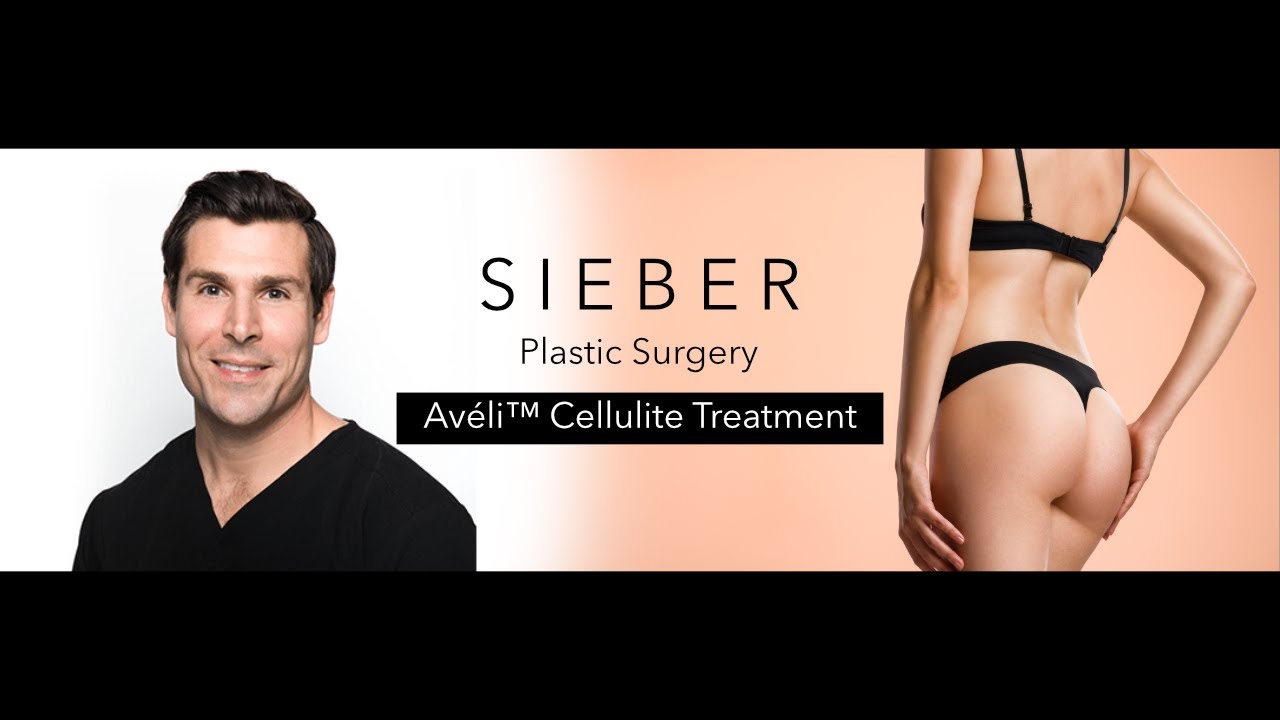 Aveli cellulite treatment- David Sieber, M.D. Plastic Surgeon in San Francisco Bay Area