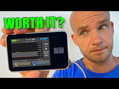 Tandem t:slim X2: Full Insulin Pump Review
