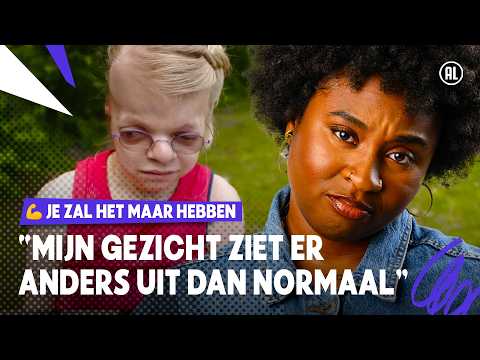EMMA HEEFT HET SYNDROOM VAN PFEIFFER! 😢 | Je Zal Het Maar Hebben Jr. | seizoen 2 #2 | NPO Zapp