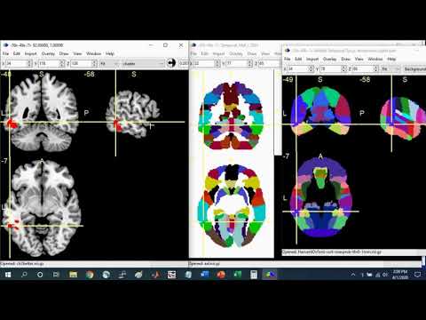MRIcron Brain Region of Interest (ROI) Guide Part 1