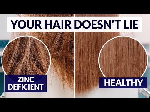 How To Get A Hair Analysis To Test For Nutrient...
