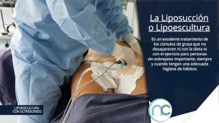 Liposucción - Dr. Nelson Chaves