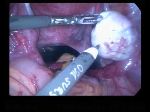 Rajani Hospital Video 5
